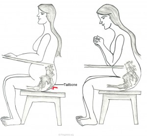 Tailbone Pain