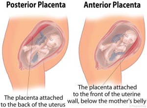 Anterior Placenta Picture