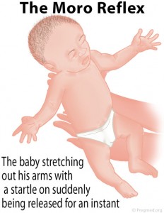 Moro Reflex