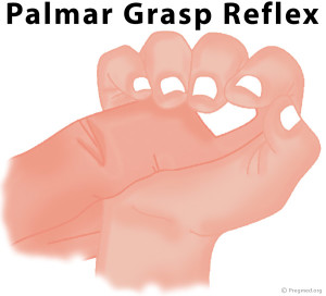 Palmar Grasp Reflex