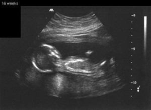16 Weeks Pregnant Ultrasound Picture