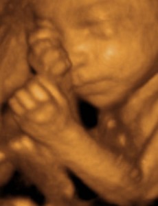 25 Weeks Pregnant 3D Ultrasound Picture