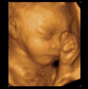 28 Weeks Pregnant 3D Ultrasound Picture
