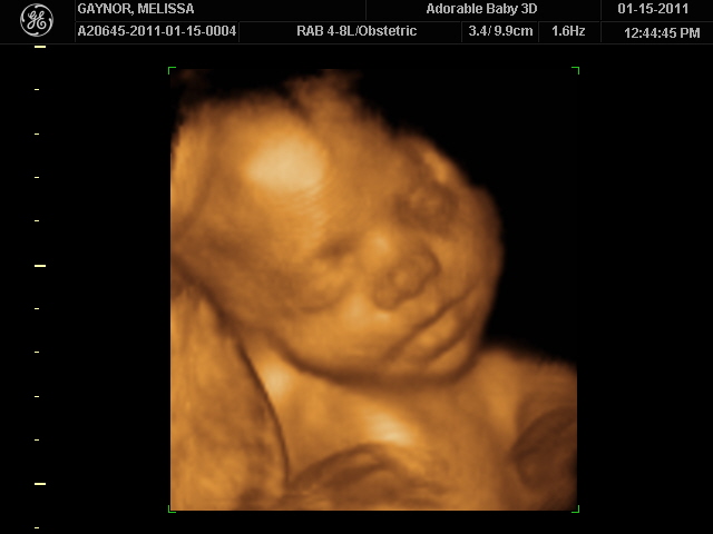 29 Weeks Pregnant Ultrasound Image