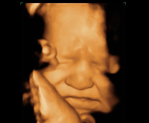 39 Weeks Pregnant Ultrasound Picture